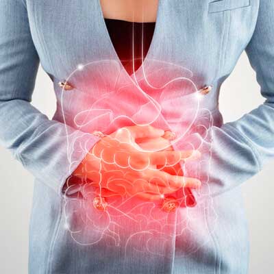 Seminario-Doenca-Inflamatoria-Intestinal